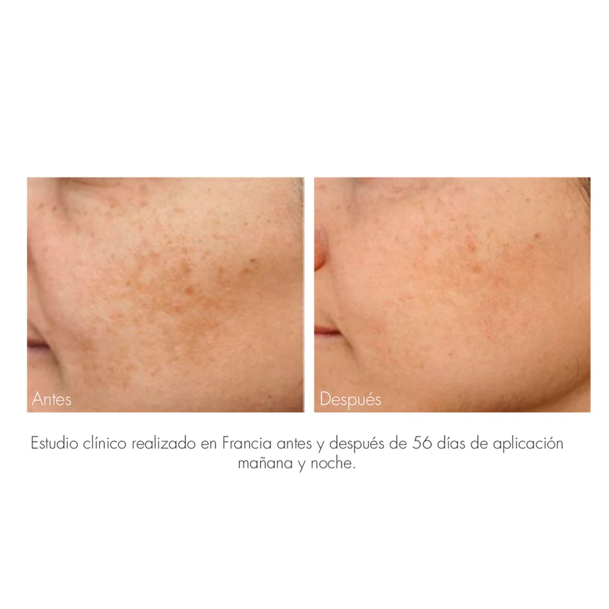 Nuhanciam Serum Antimanchas 30 ml.