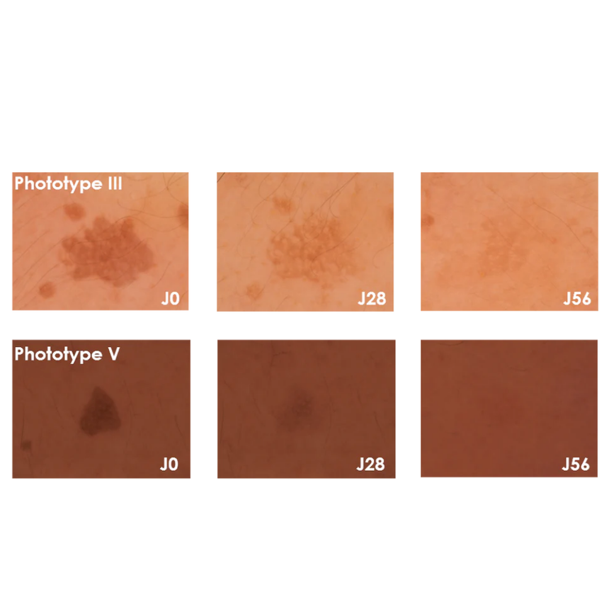 Nuhanciam Serum Antimanchas 30 ml.