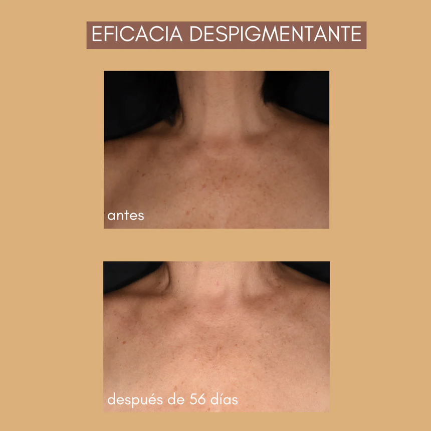 Nuhanciam Leche Corporal Despigmentante 500 ml.