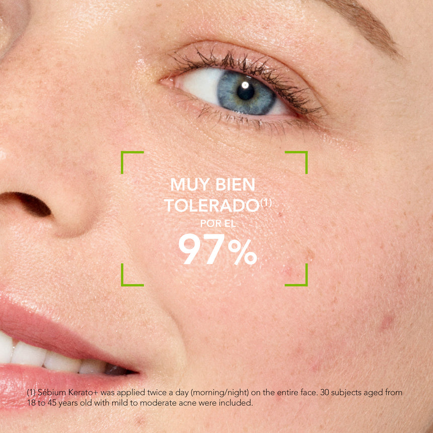 Tratamiento Bioderma Sébium Kerato+ 30 ml