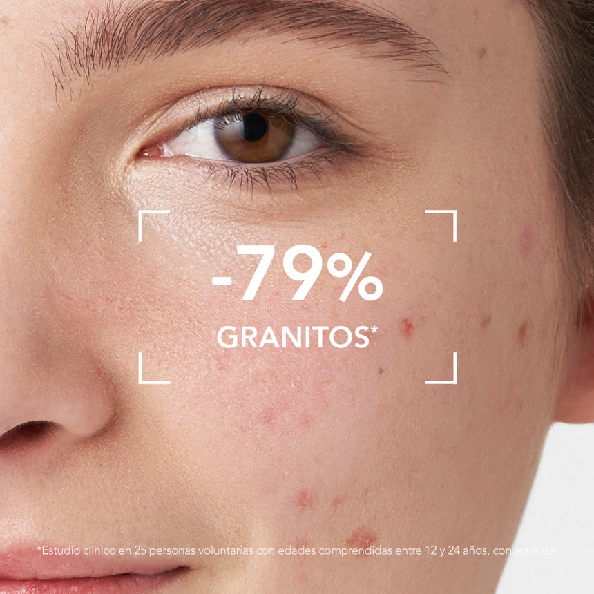 Tratamiento Bioderma Sébium Global 30 ml