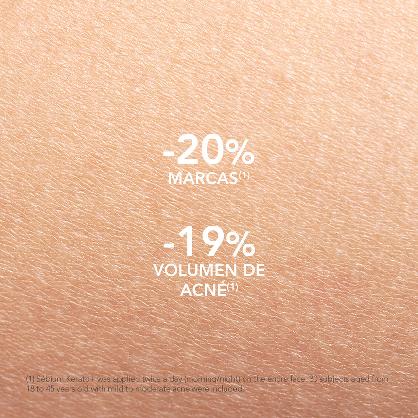Tratamiento Bioderma Sébium Kerato+ 30 ml