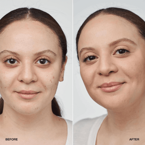 Base CN 52 Neutral Clinique Even Better Clinical 30 ml