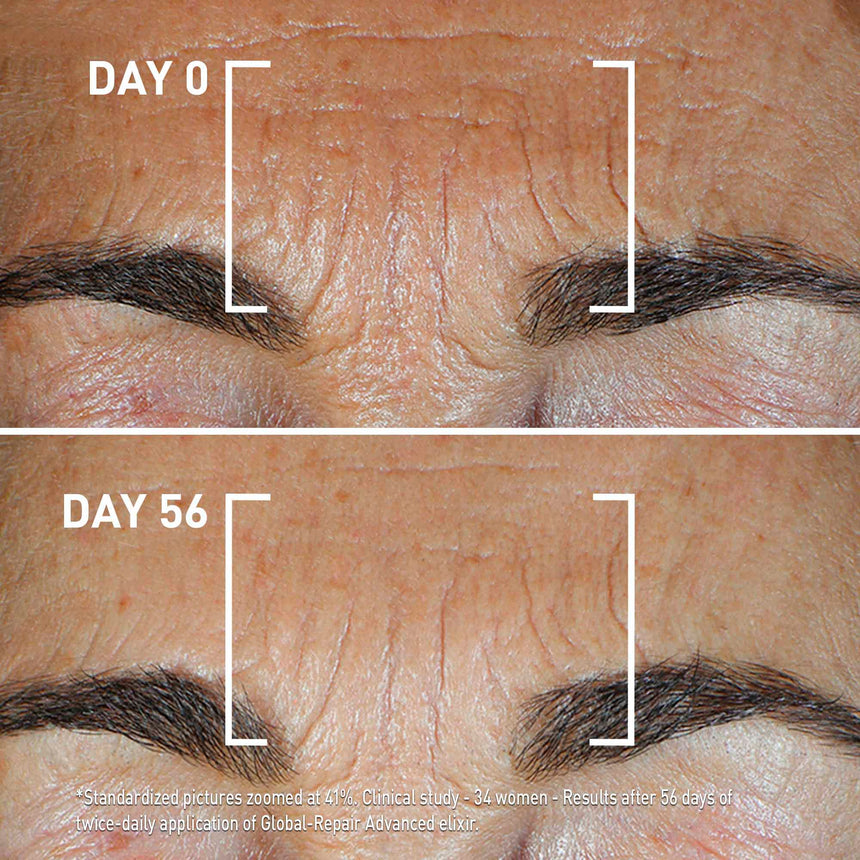 Filorga Global Repair Elixir 30 ml.