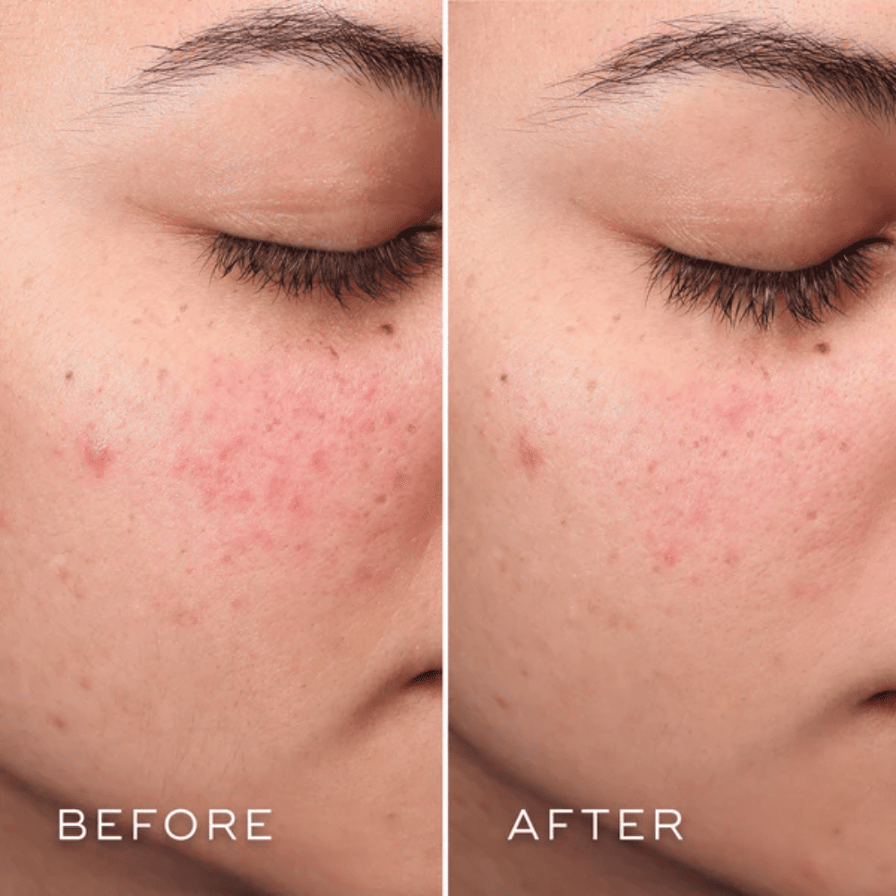 Medik8 Press & Clear Refill 150 ml.