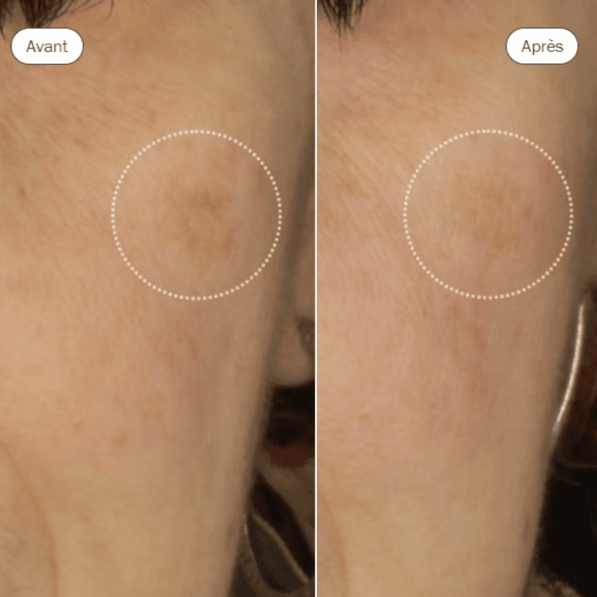 Novexpert Booster Serum With Green Tea Polyphenols 30 ml.