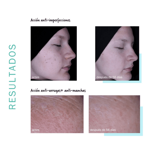 Novexpert Fluido Purificante con Trio-Zinc 30 ml.