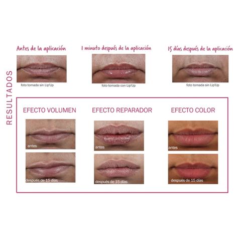 Novexpert Lip'Up con Ácido Hialurónico 8 ml.