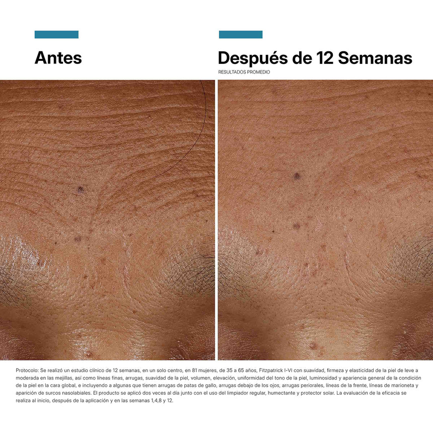 Skinceuticals Serum de Ácido hialurónico HA Intensifier Multi-Glycan 30 ml.