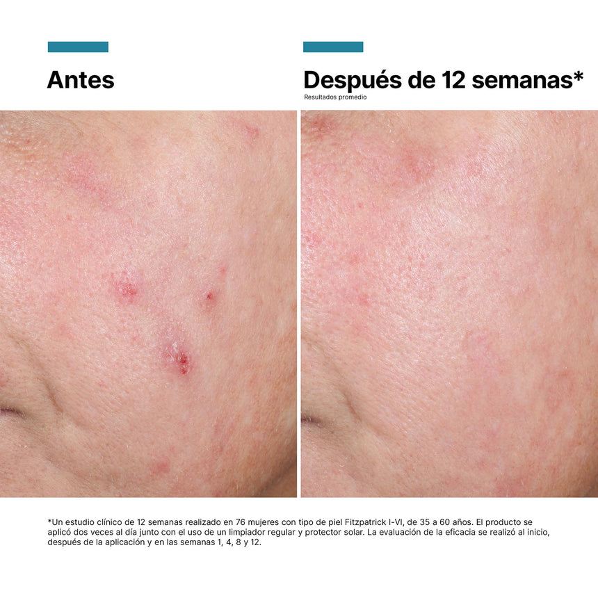 Skinceuticals Crema Regeneradora Advanced RGN-6 50 ml.