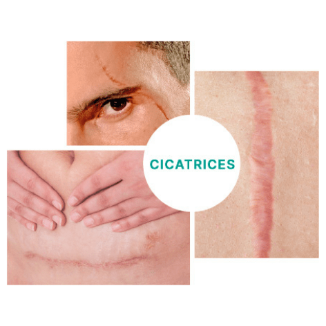 Lsi Sodermix Crema 30 g.