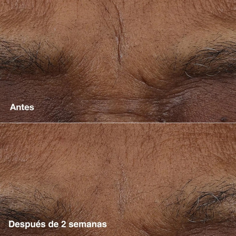 Clinique Smart Clinical Barra de Retinol 3 g.