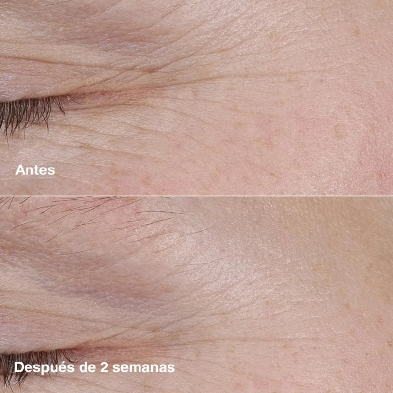 Clinique Smart Clinical Barra de Retinol 3 g.
