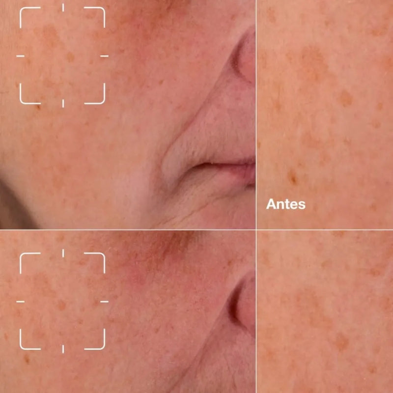 Clinique Even Better Clinical Dark Spot Clearing Serum 30 ml.