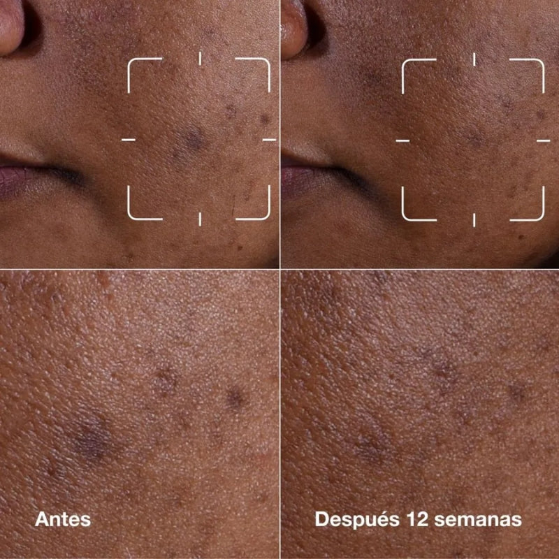 Clinique Even Better Clinical Dark Spot Clearing Serum 50 ml.