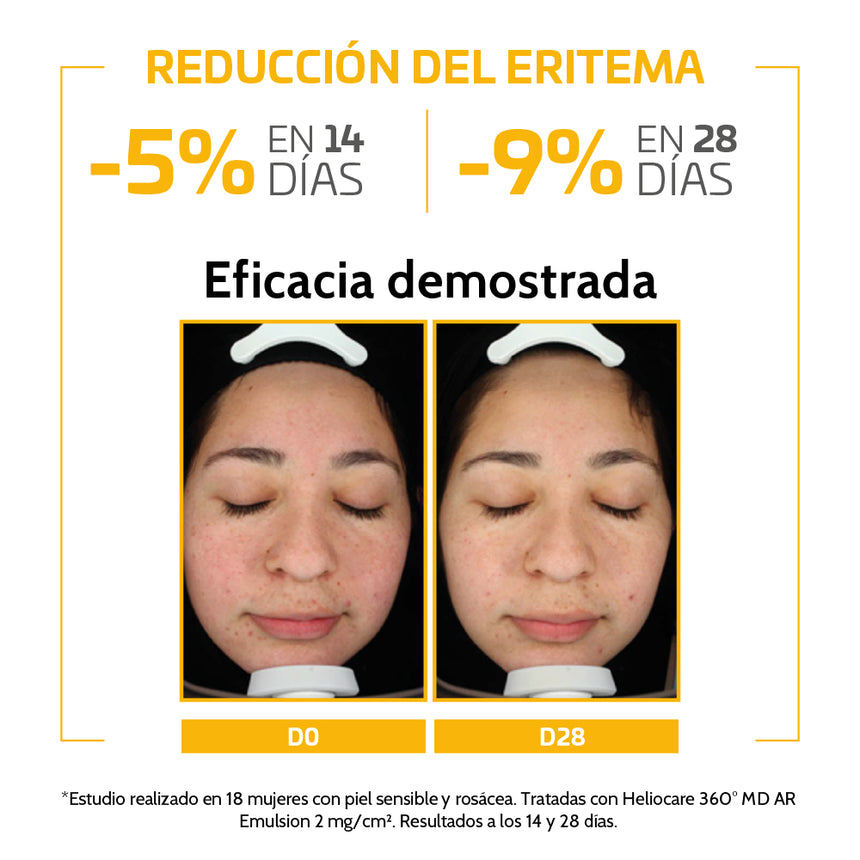 Fotoprotector HELIOCARE 360º MD A-R Emulsion SPF 50+ 50 ml.