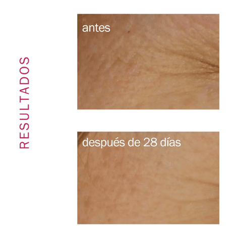 Novexpert Booster Serum con Ácido Hialurónico 30 ml.