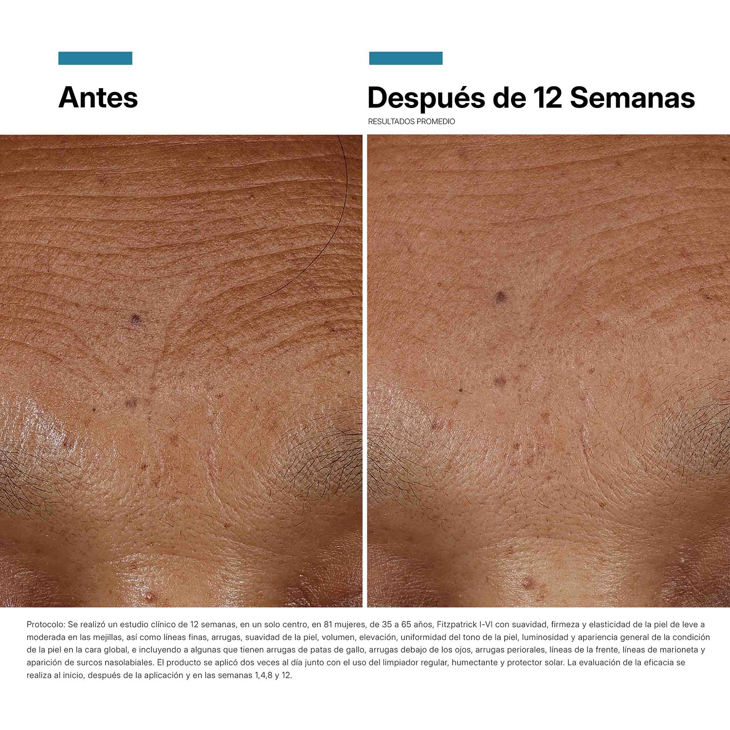 Skinceuticals Serum de Ácido hialurónico HA Intensifier Multi-Glycan 30 ml.