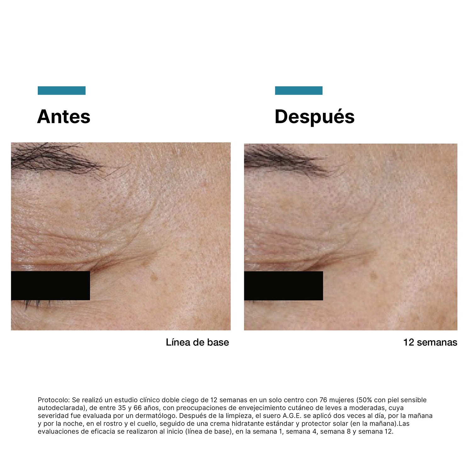 SkinCeuticals A.G.E Interrupter Ultra Serum Antiedad Efecto Lifting 30ml.