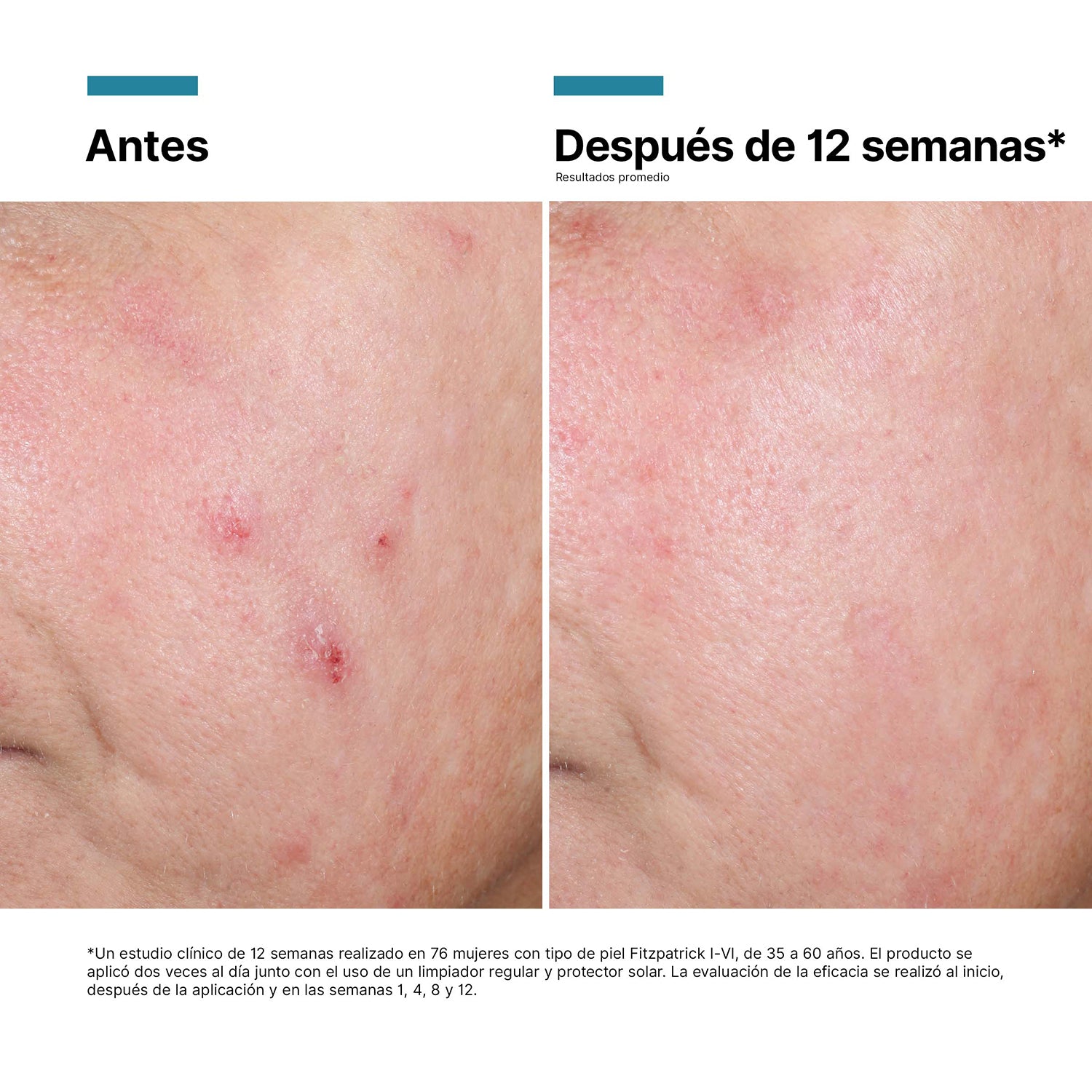 Skinceuticals Crema Regeneradora Advanced RGN-6 50 ml.