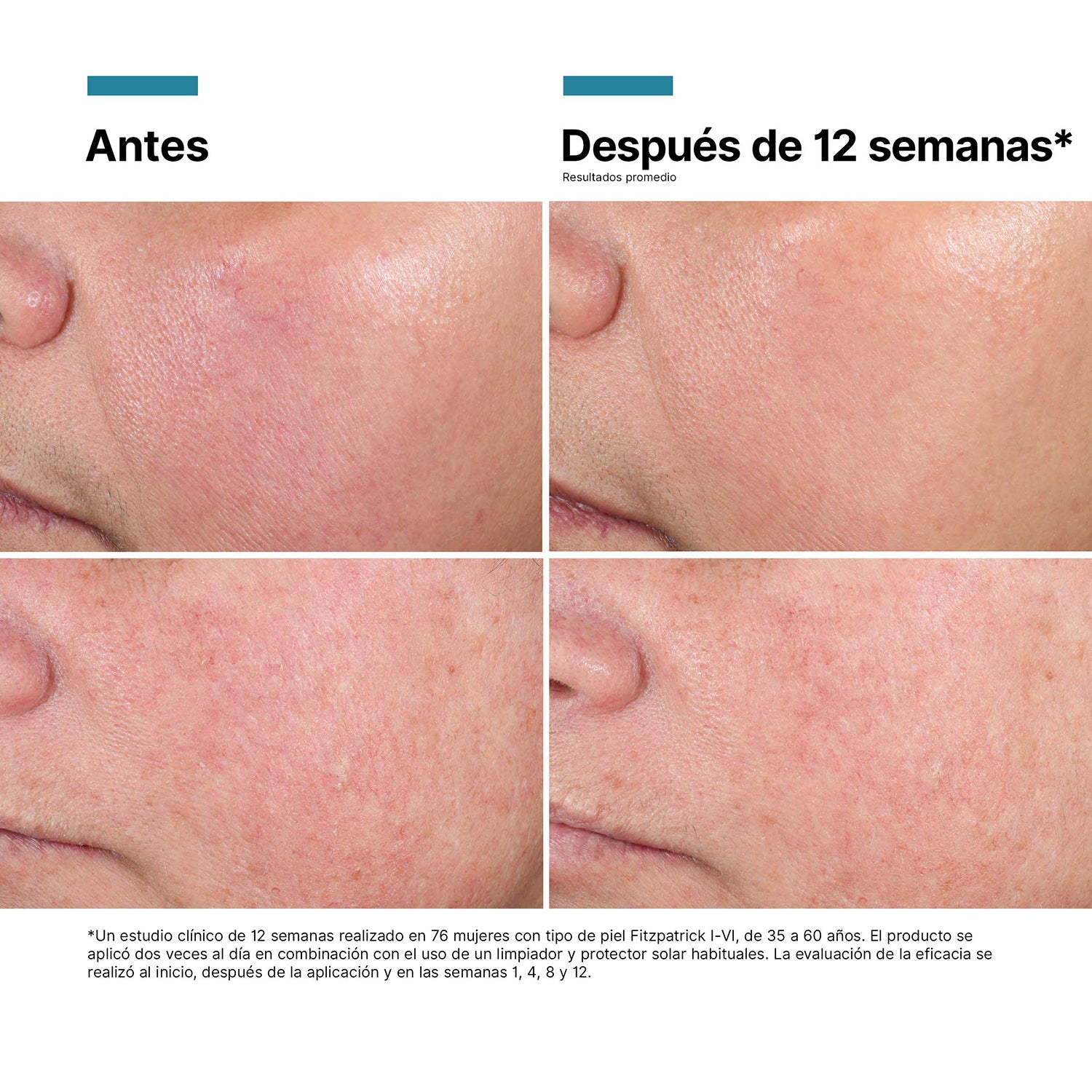 Skinceuticals Crema Regeneradora Advanced RGN-6 50 ml.