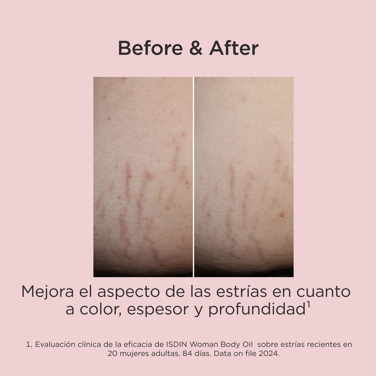 Aceite Corporal ISDIN Woman Body Oil Multibeneficio para la Piel 100 ml